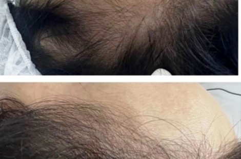 Hair-трихология: возрождение волосяного фолликула, рост и укрепление волос